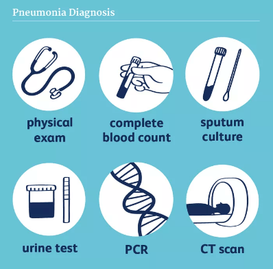 Fibrosi polmonare: cause, trattamento e prevenzione