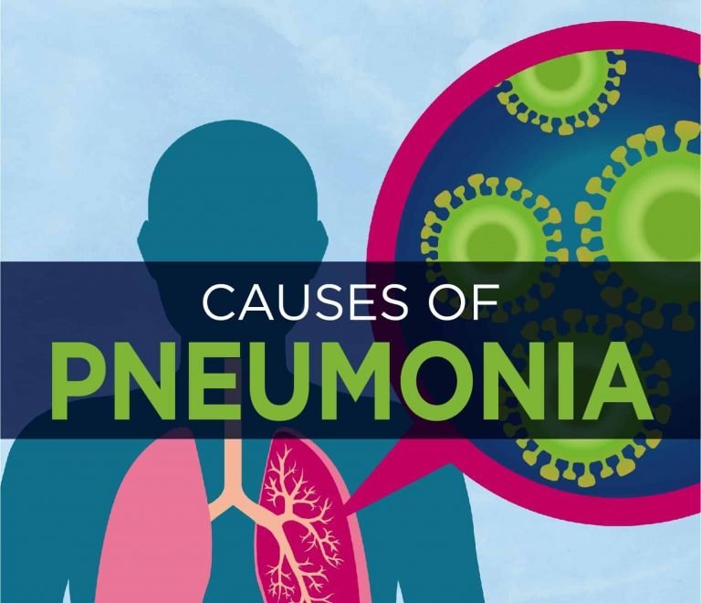 Symptoms Of Pneumonia Causes And Treatment Methods Greenbhl