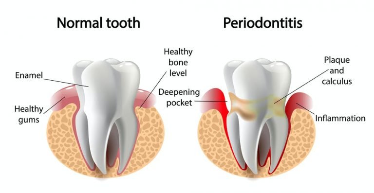 Anatomía dental, enfermedades y tratamientos para los dientes