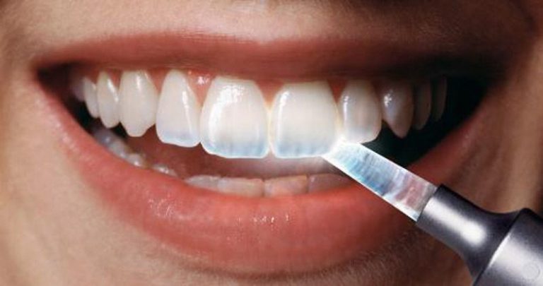 Anatomía dental, enfermedades y tratamientos para los dientes