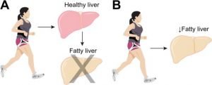 What is the best way to reduce fatty liver naturally?