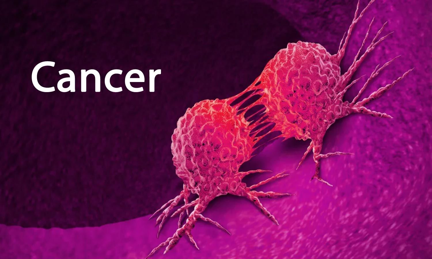 Cancer: Everything about cancer, symptoms, diagnosis, and treatment