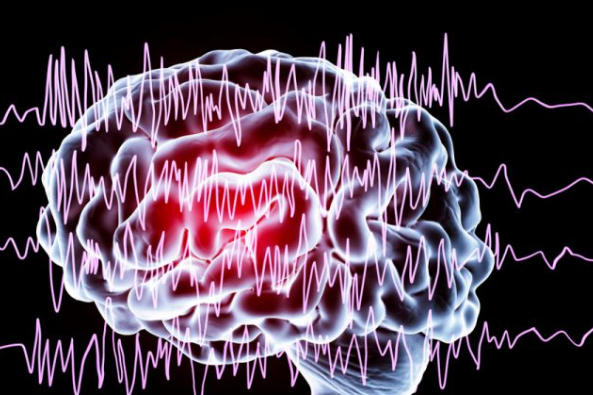 Was ist Epilepsie? Ursache und Behandlungsmethoden