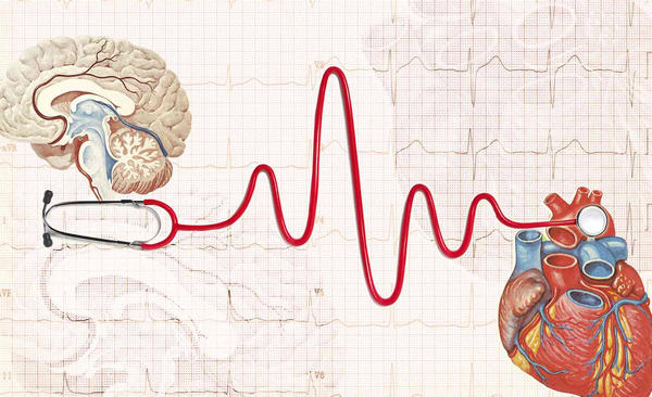 Die Unterschiede zwischen Schlaganfall- und Herzinfarkt-Symptomen
