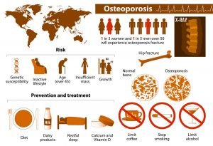 early warning signs of osteoporosis