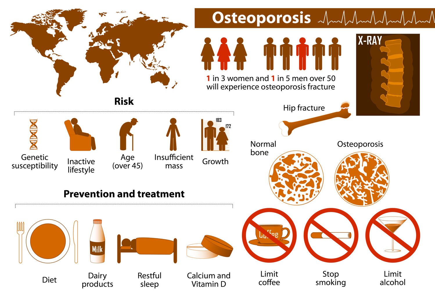 Osteoporosis Symptoms and treatment of osteoporosis GreenBHL