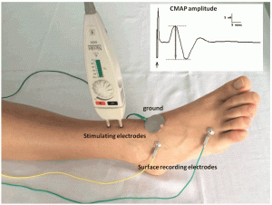 17 herbal remedies for plantar fasciitis