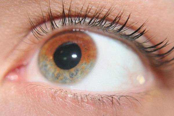 Worrying reasons for eye discoloration