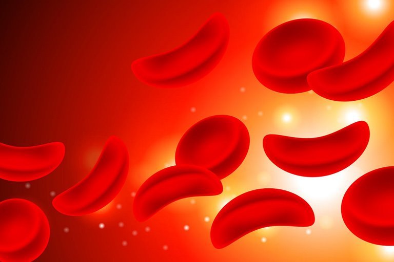 What is anemia? Treatment methods + video