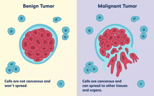 Cancer : Everything about cancer + video