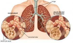 Everything about the lungs; Know the function, disease and treatment of the lungs