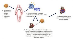 Autoimmune diseases; Causes, symptoms, types, and methods of treatment