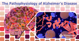 Alzheimer's disease - Everything about dementia and its symptoms