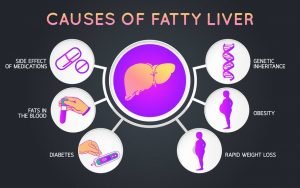 What is the best way to reduce fatty liver naturally?