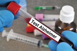 Alzheimer's disease - Everything about dementia and its symptoms