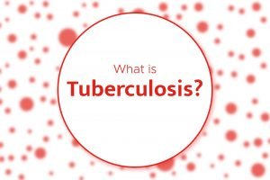 Tuberculosis: Everything about the symptoms, diagnosis and treatment of tuberculosis