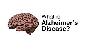 Alzheimer's disease - Everything about dementia and its symptoms
