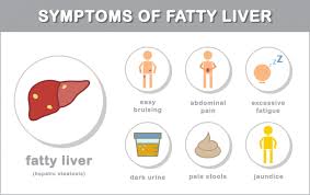 What is the best way to reduce fatty liver naturally?