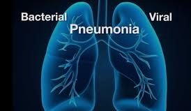 Symptoms that confirm pneumonia