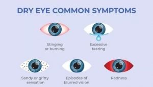 Causes of "dry eye" and the best ways to treat it