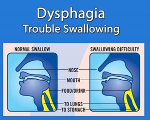 Does a disease cause salivation in sleep?