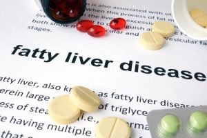 What is the best way to reduce fatty liver naturally?