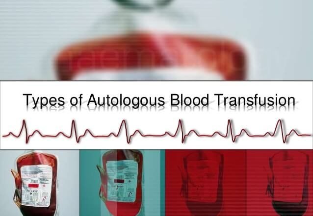 Blutspende: Eine eingehende Analyse ihrer Vor- und Nachteile