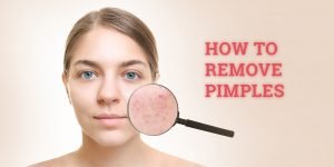 Quick ways to reduce acne and pimples on the face