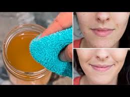 Quick ways to reduce acne and pimples on the face