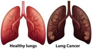 Terrible effects of smoking on every organ of the body