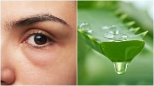 Causes of "dry eye" and the best ways to treat it