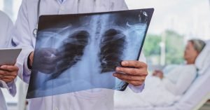 Tuberculosis: Everything about the symptoms, diagnosis and treatment of tuberculosis