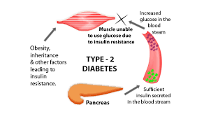 How can I prevent diabetes naturally