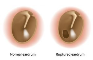 Learn everything you need to know about ear washing