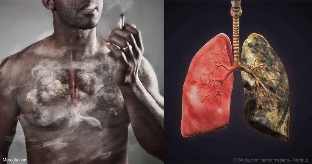 Terrible effects of smoking on every organ of the body – GreenBHL