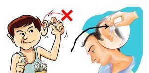 Learn everything you need to know about ear washing