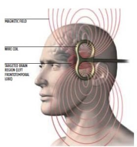 Bipolar disorder; Everything about symptoms and cause and treatment