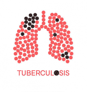 Tuberculosis: Everything about the symptoms, diagnosis and treatment of tuberculosis