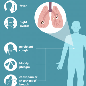 Tuberculosis: Everything about the symptoms, diagnosis and treatment of tuberculosis