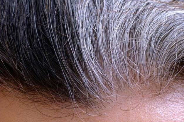 All the factors that can cause premature graying of hair