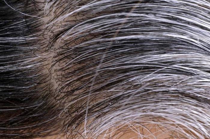 Premature hair greying treatment