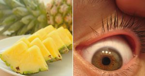 Familiarity with all the properties and benefits of pineapple for health