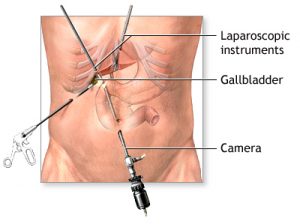 What is a gallbladder? How does it work in the body?