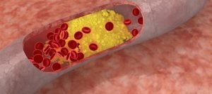 What is the main difference between cholesterol and triglycerides?