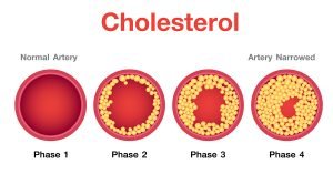 What is the main difference between cholesterol and triglycerides?