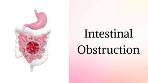 What is intestinal obstruction, and how is it treated?