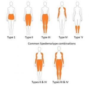 What is the main difference between cholesterol and triglycerides?