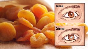 Properties of apricot and all the positive effects of this summer fruit