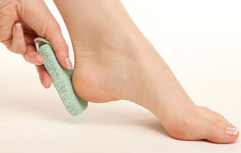Foot crack treatment; Home remedies are always useful