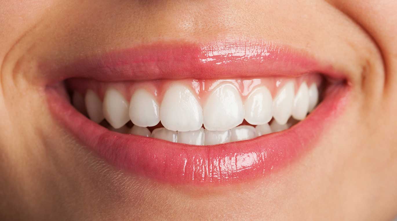 Why do teeth turn yellow? Tips to prevent and eliminate tooth yellowing